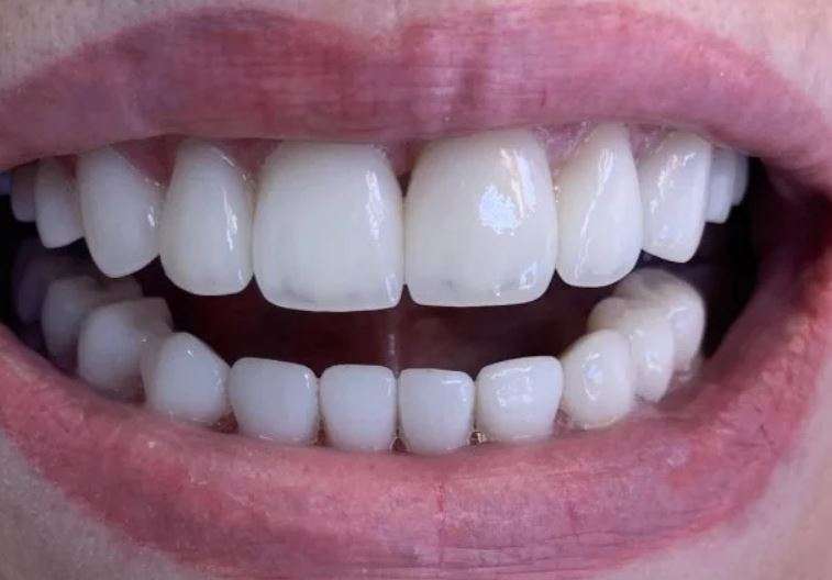 Портфолио - фото Гермес Дент