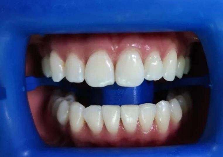 Портфолио - фото Гермес Дент