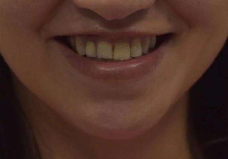 Портфолио - фото Гермес Дент