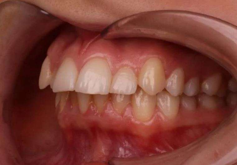 Портфолио - фото Гермес Дент