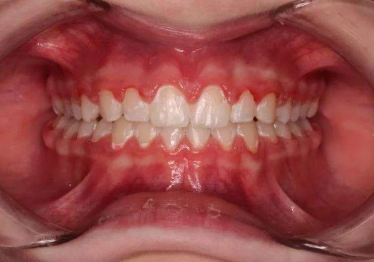 Портфолио - фото Гермес Дент
